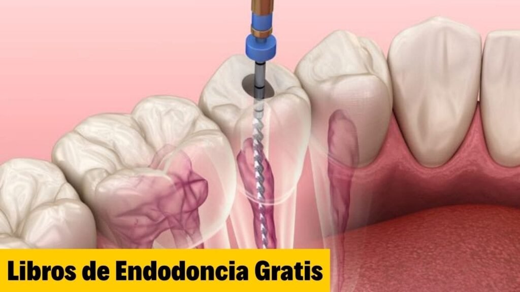 Libros de Endodoncia Gratis